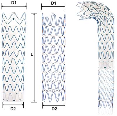 Clinical Results and Aortic Remodeling After Endovascular Treatment for Complicated Type B Aortic Dissection With the “Fabulous” Stent System